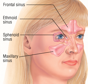 Sinusitis Drugs Market