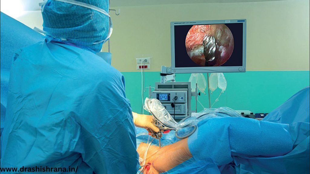Hip Arthroscopy Surgeon in Jaipur