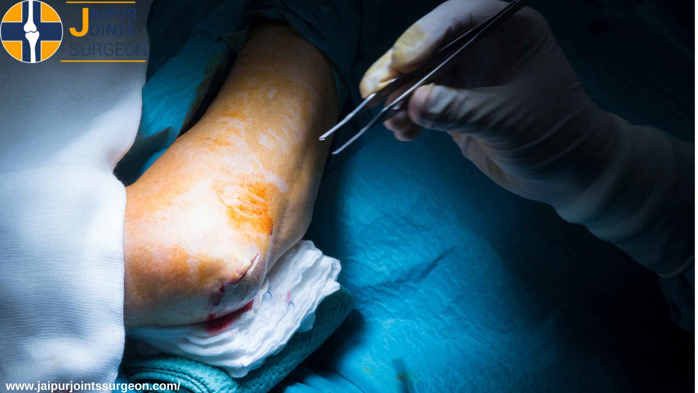 Best Doctor For Elbow Replacement Surgery In Jaipur - Dr Ashish Rana