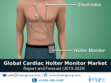 Cardiac Holter Monitor Market Overview, Driving Factors, Key Players and Growth Opportunities by 2024