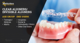 Europe Clear Aligners Market to be Worth $5.43 Billion by 2030