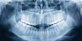 Dental X-Ray Market Size, Share Analysis, Key Companies, and Forecast To 2030