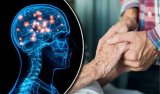 Huntington’s Disease Treatment Market Is Estimated To Witness High Growth Owing To Increasing Prevalence of the Disease