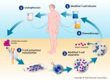 Exploring Growth Prospects and Trends in the Leukapheresis Market: A Comprehensive Analysis