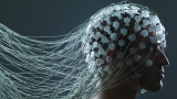 Neuroprosthetics Market Global Insights and Latest Advancement Report
