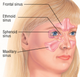 Sinusitis Drugs Market: 2019 Trends, Segmentation and Opportunities Forecast To 2026