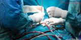 Expert Guide To Understanding Heart Care – Best Open Heart Surgeon In Bhavnagar