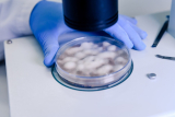 How Accurate Is SDS Page Analysis in Biologics?