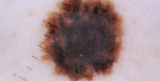 Finding Your Glow: A Guide to the Best Dermatologist in Irvine and Orange, CA